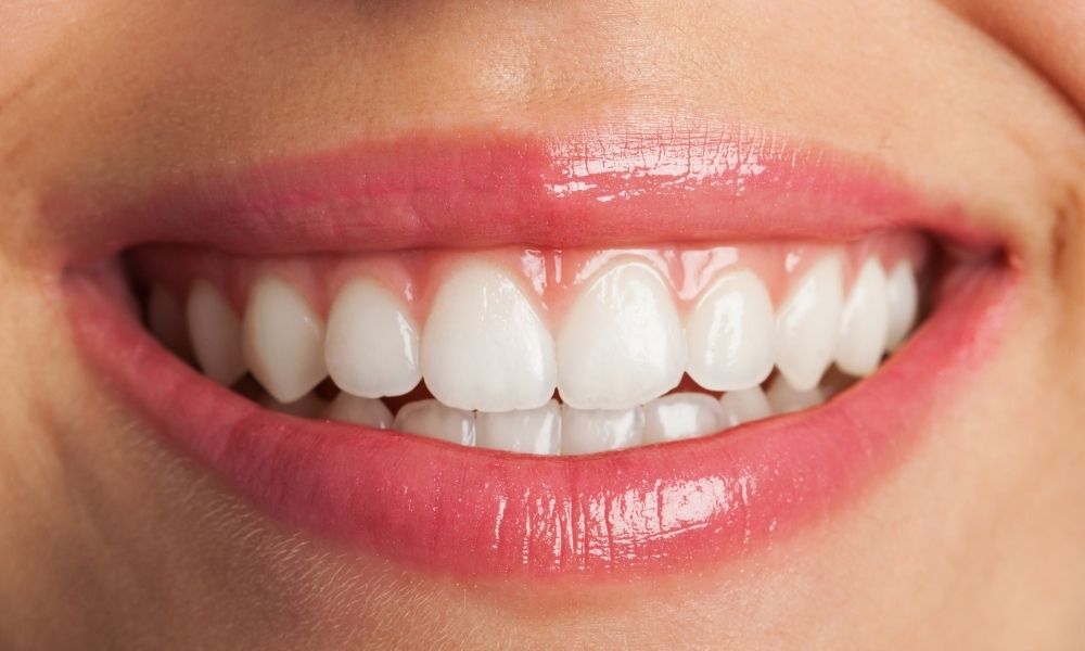 The Quiet Power of Teeth Whitening