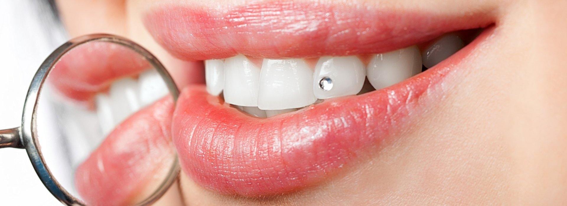 DENTAL JEWELLERY