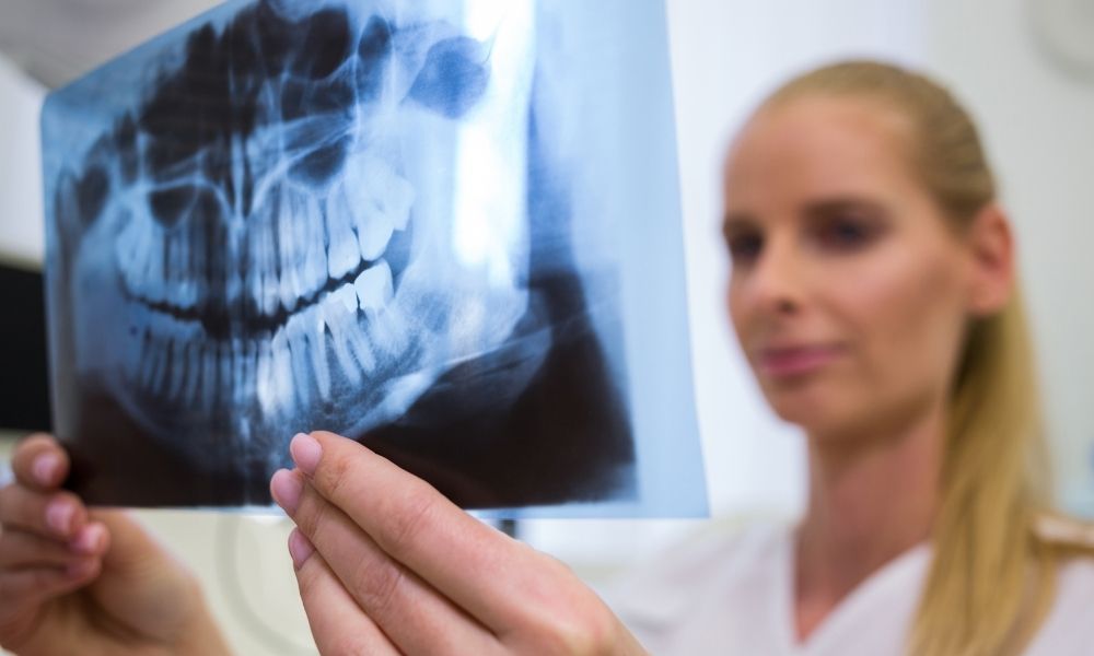 The Role of Maxillofacial X Rays and Scans