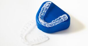 invisalign aligners